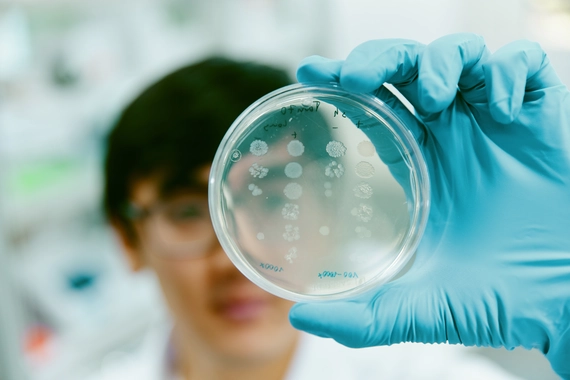 Laboratory technician holding petri dish with bacterial culture